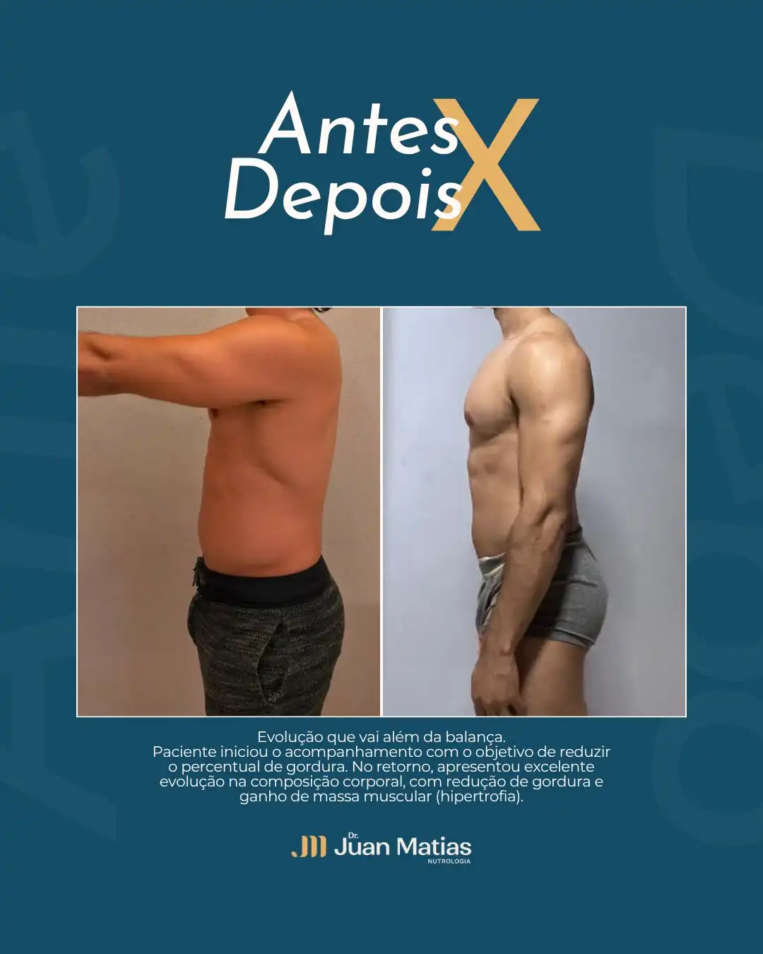 Antes e depois de paciente na menopausa após 8 meses de acompanhamento nutrológico em Brasília